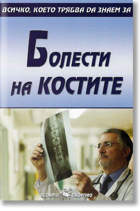Всичко, което трябва да знаем за: Болести на костите