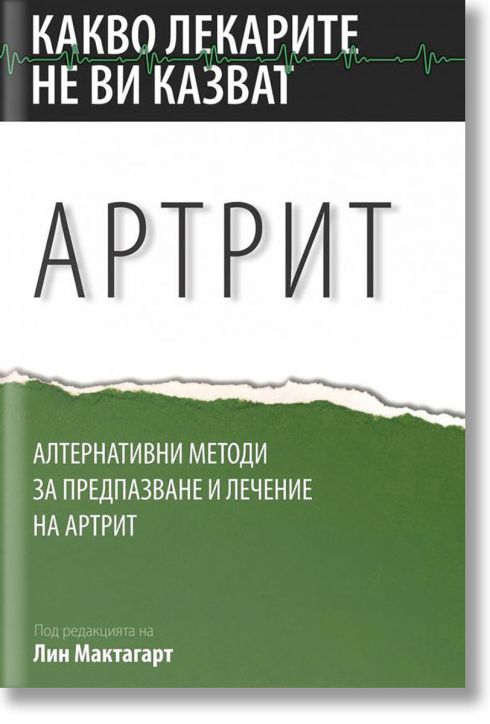 Какво лекарите не ви казват: Артрит